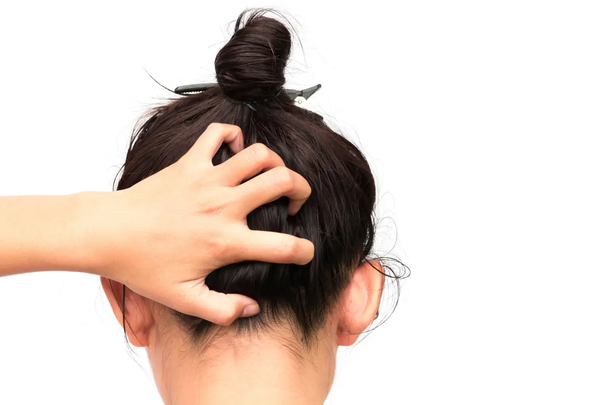 Understanding the underlying causes of dandruff is crucial in developing an effective hair care for dandruff.