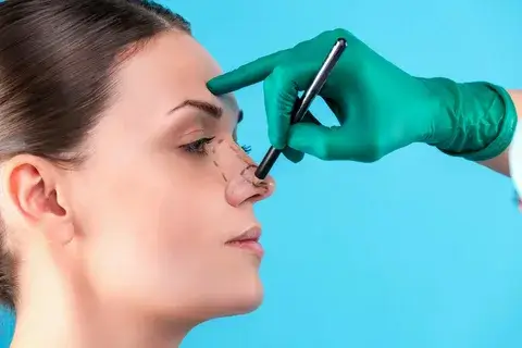 Rhinoplasty-surgery-1