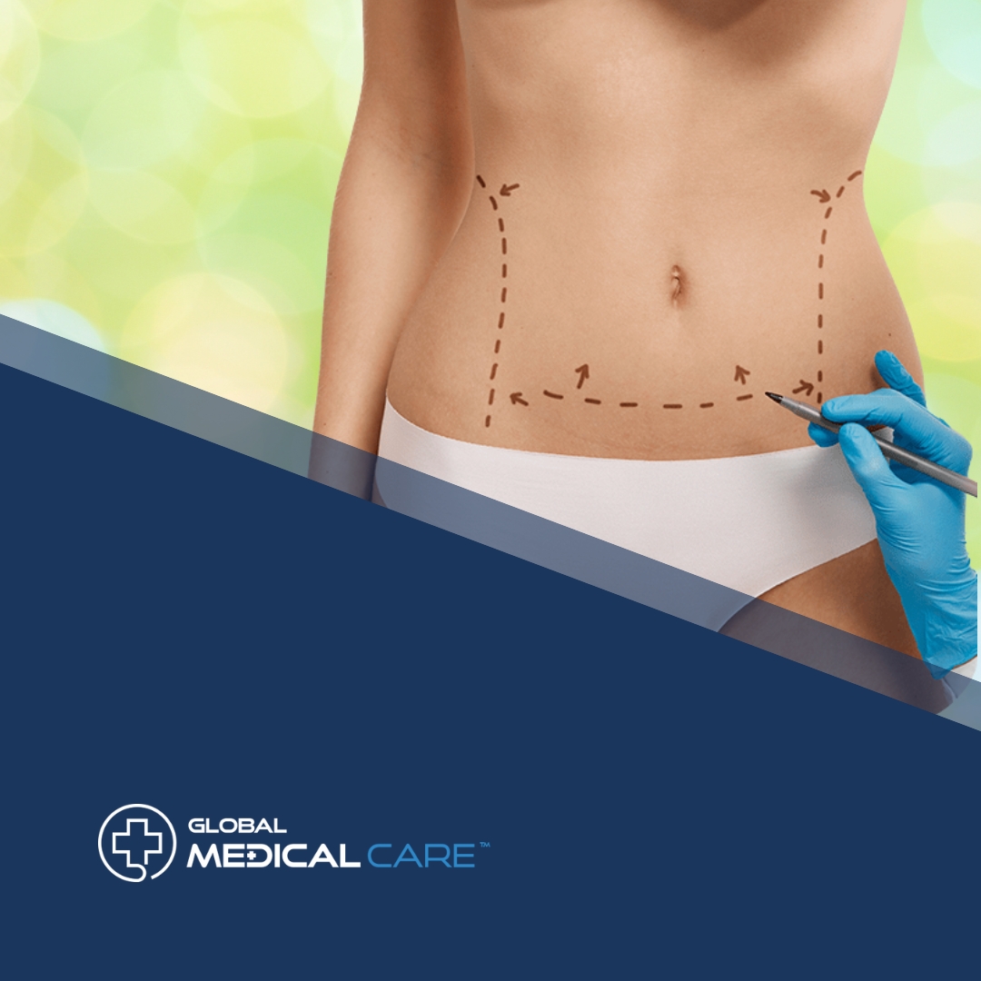 Abdominoplasty tummy tuck surgery in turkey