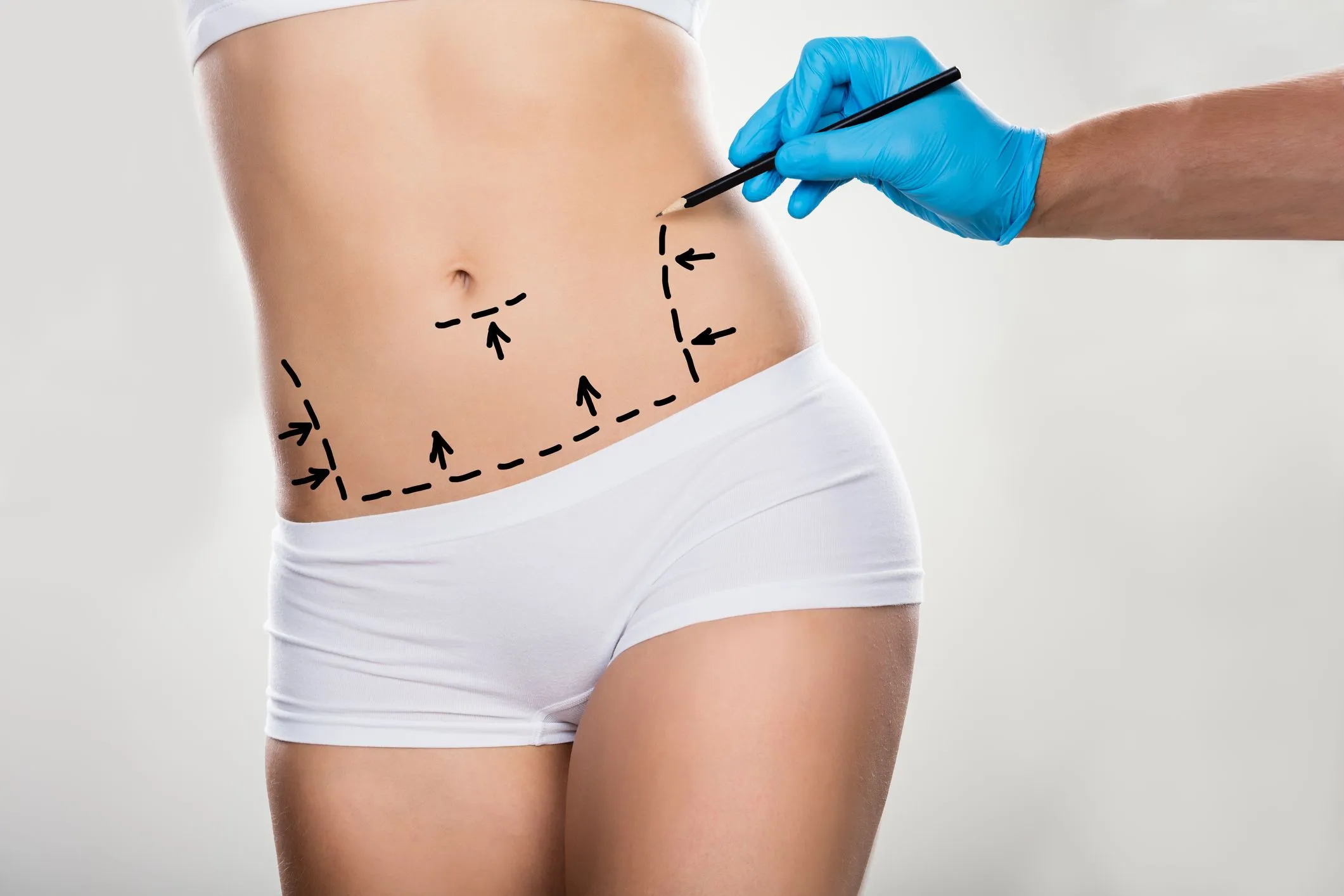 Abdominal surgery