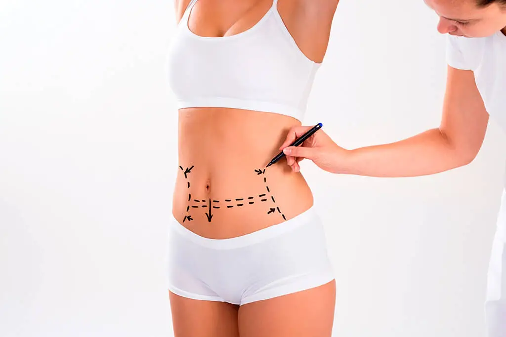 What is mini tummy tuck surgery?