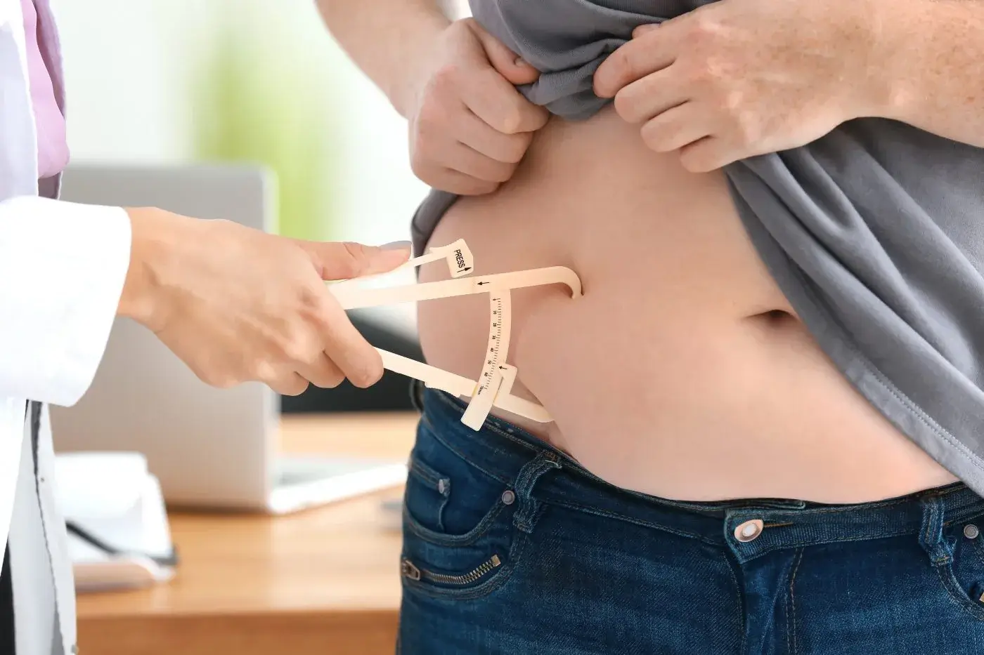 Post-Bariatric Surgery Procedure