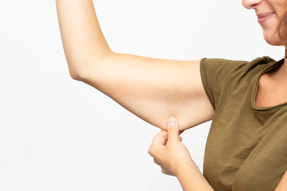 can-arm-lift-be-done-without-surgery
