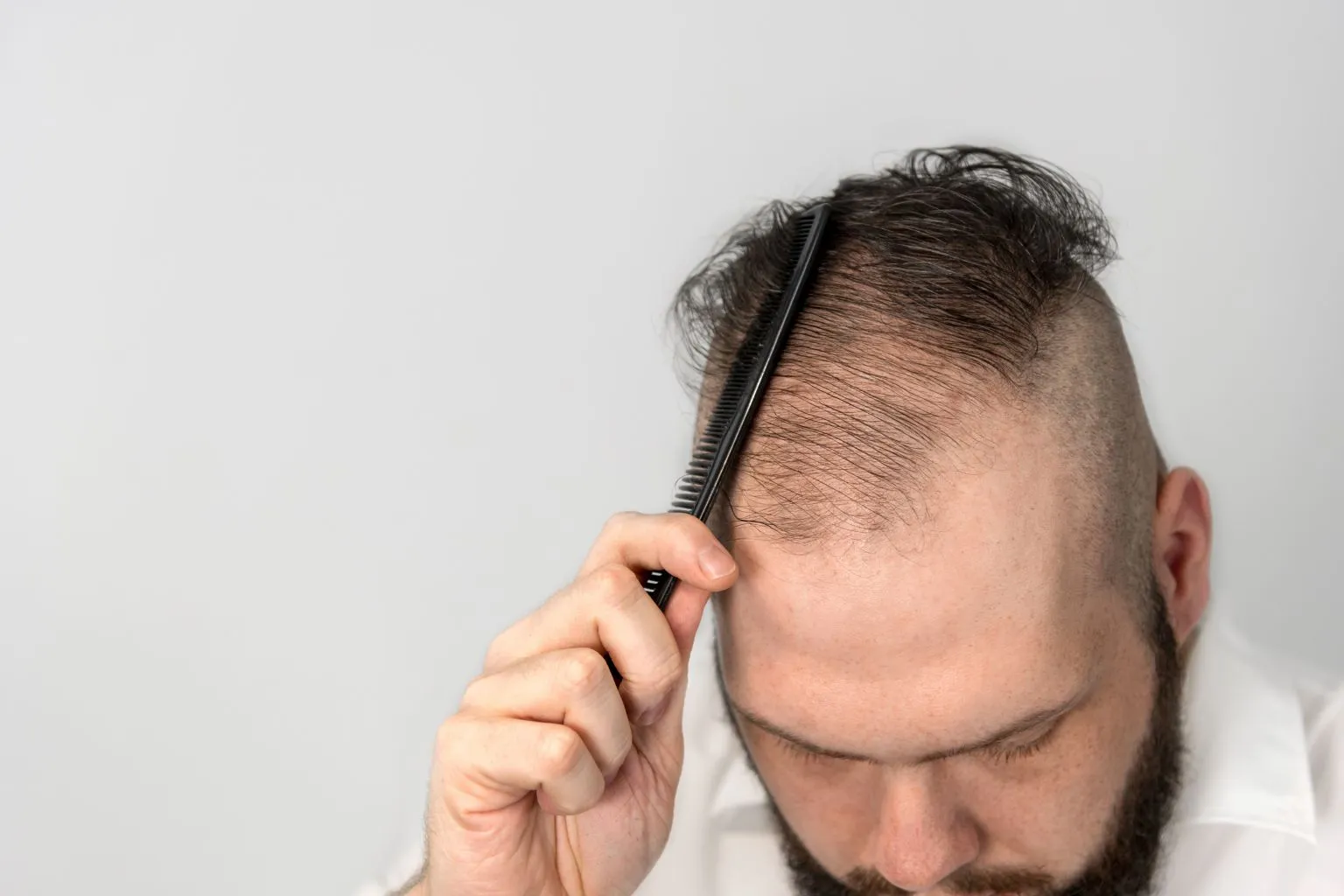Scalp Care Routine Post Hair Transplant