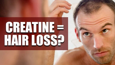 Creatine Hair Loss
