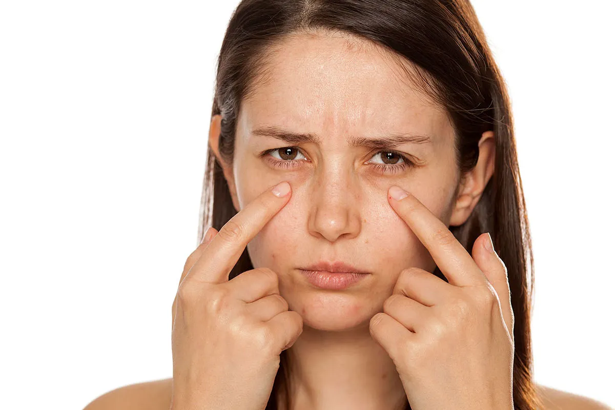 Dark undereye bags are a common concern that can make you appear tired, older, and less vibrant and affect your overall confidence.