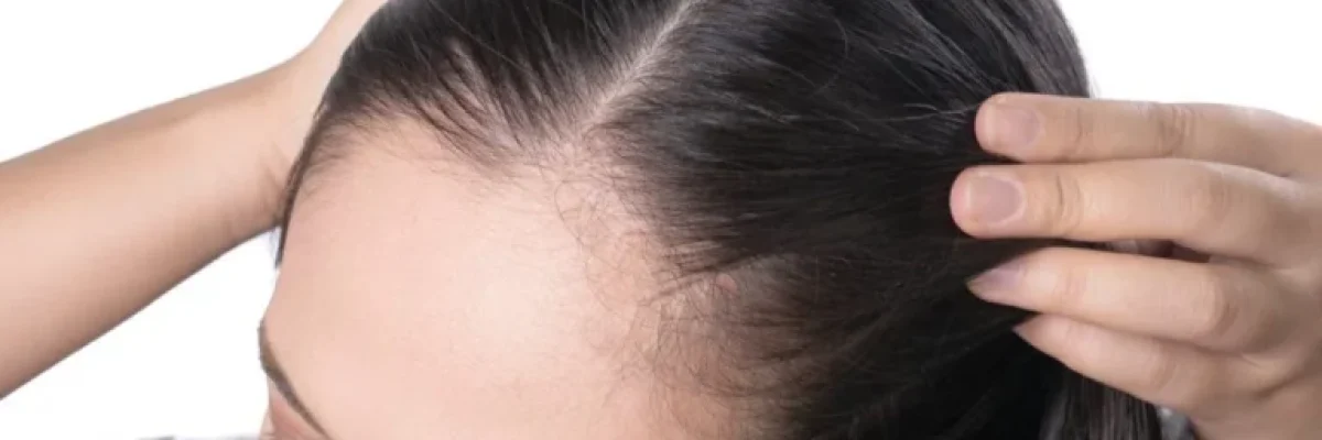 Aftercare after facelift surgery