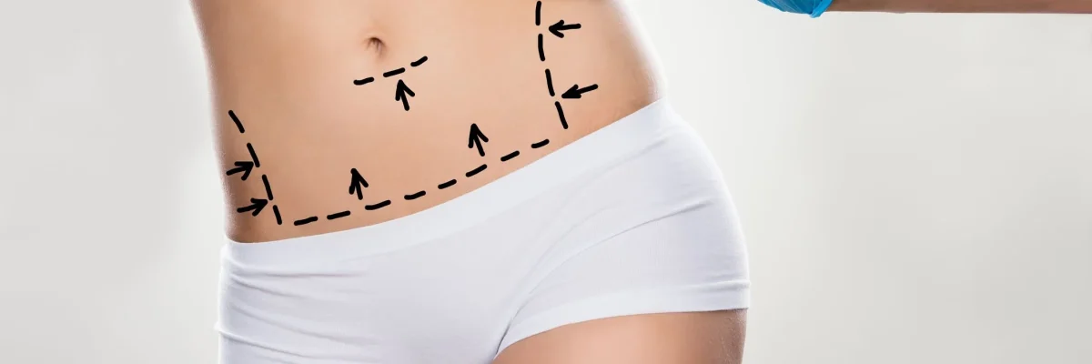 Abdominal surgery