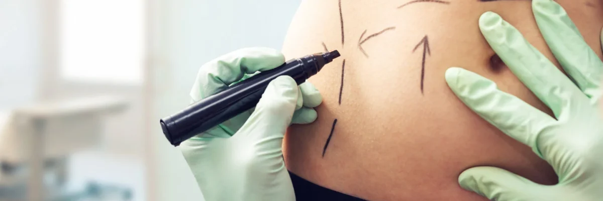 How painful is abdominoplasty