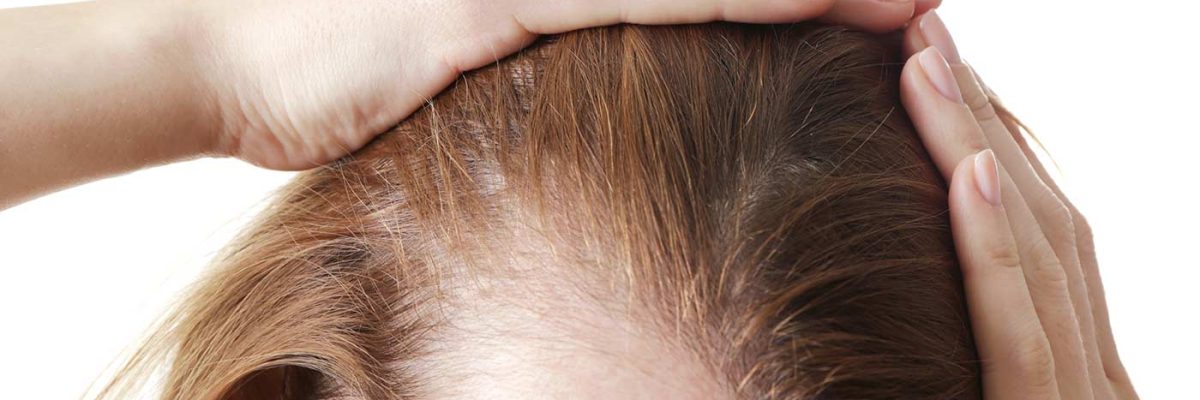 Understanding the common causes of alopecia is the first step towards effective management and treatment as this process can be daunting.
