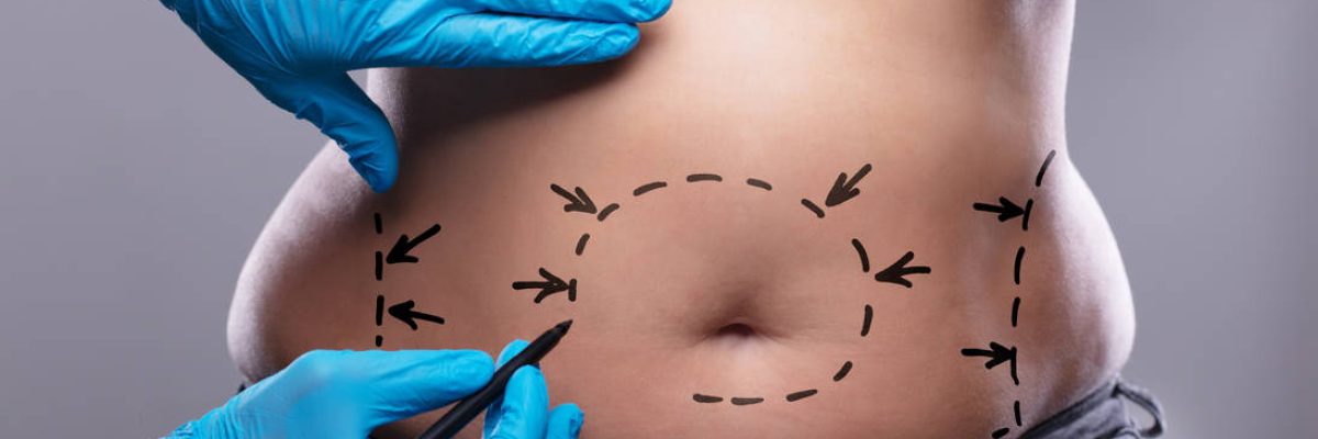 liposuction surgery turkey