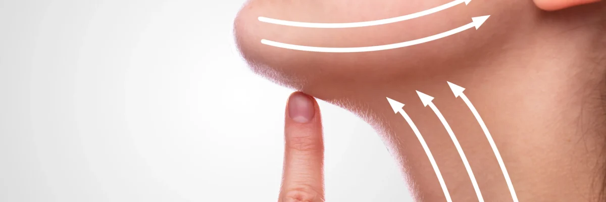 Non-surgical neck lifts have emerged as a solution for those seeking to address skin laxity, wrinkles, and a loss of definition in the neck.
