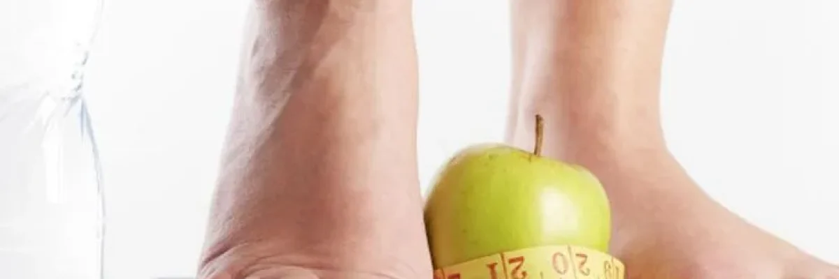 Success after bariatric surgery