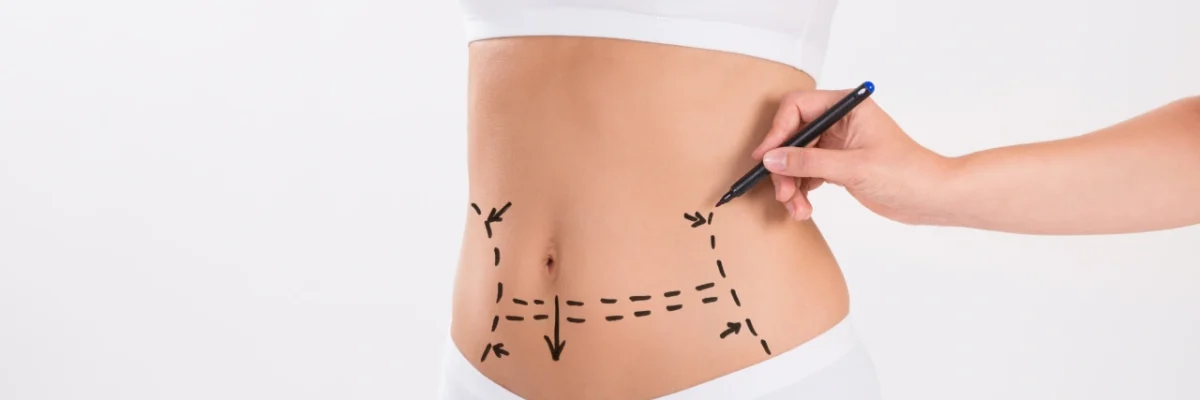 Abdominal Surgery