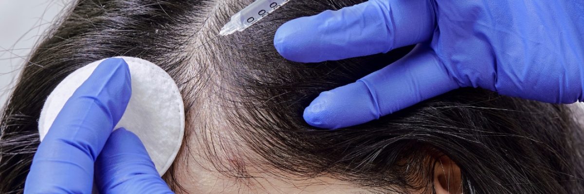 woman hair transplant surgery