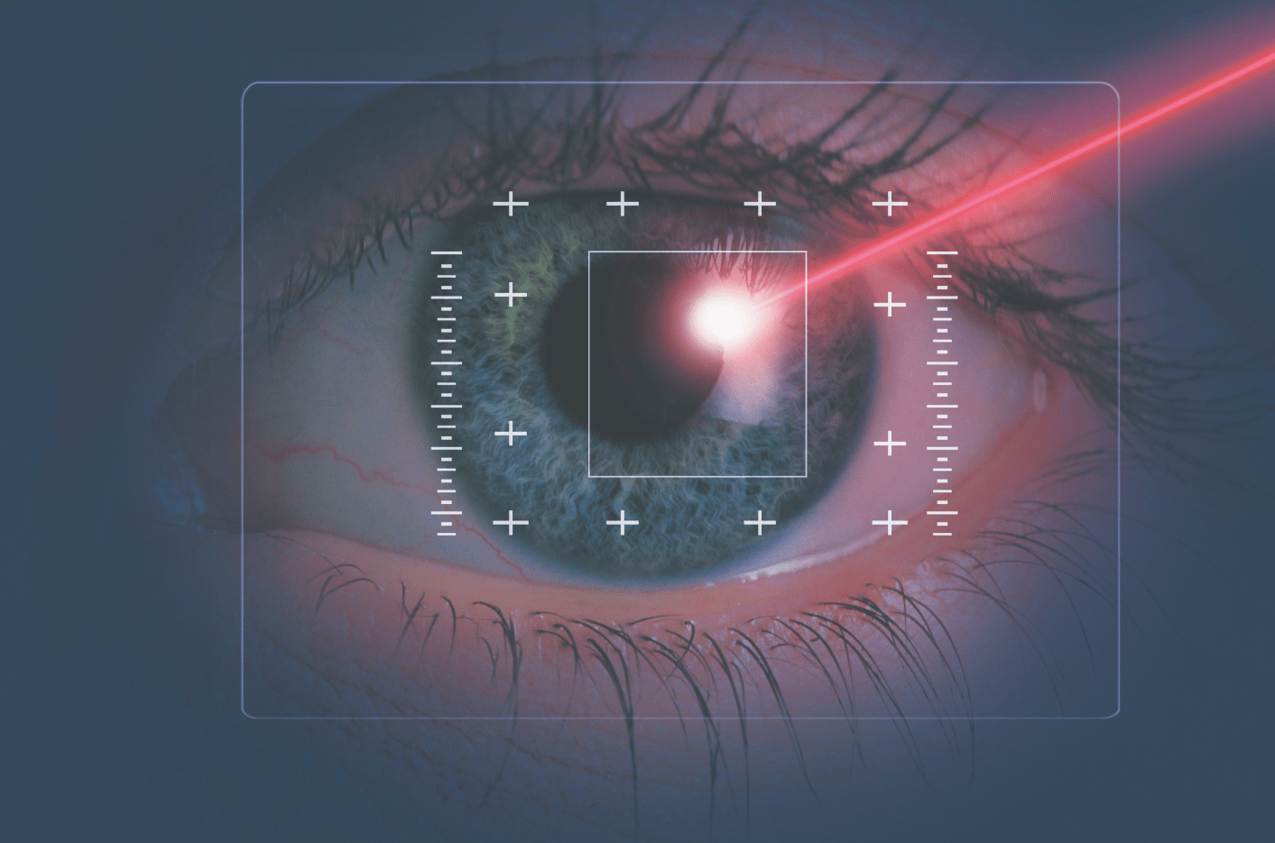eyer-laser-surgery-min