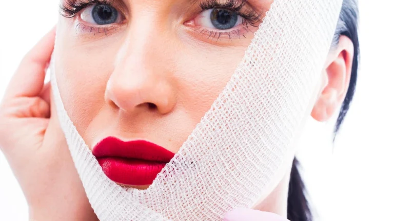 Recovery after facelift surgery