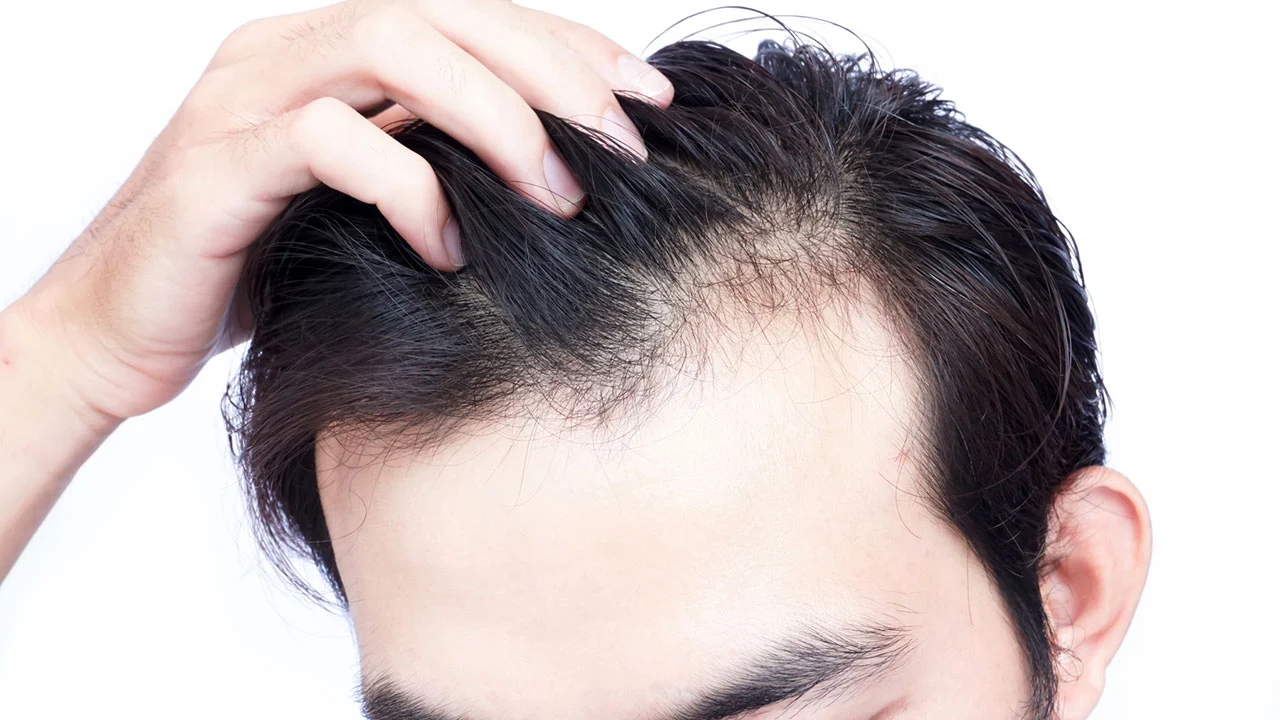 Hair Regrowth for Men