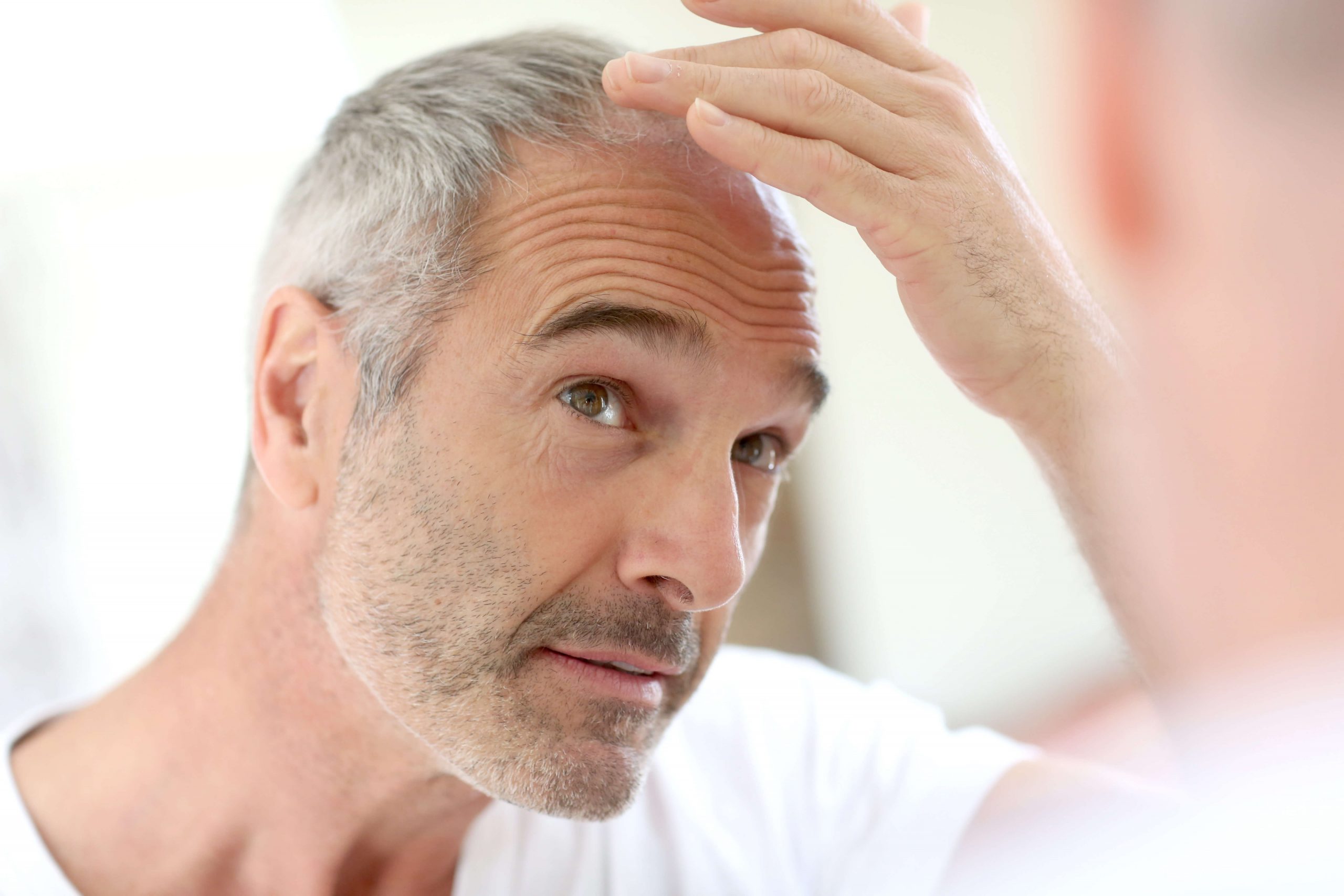 Hair transplantation for less decreased hair