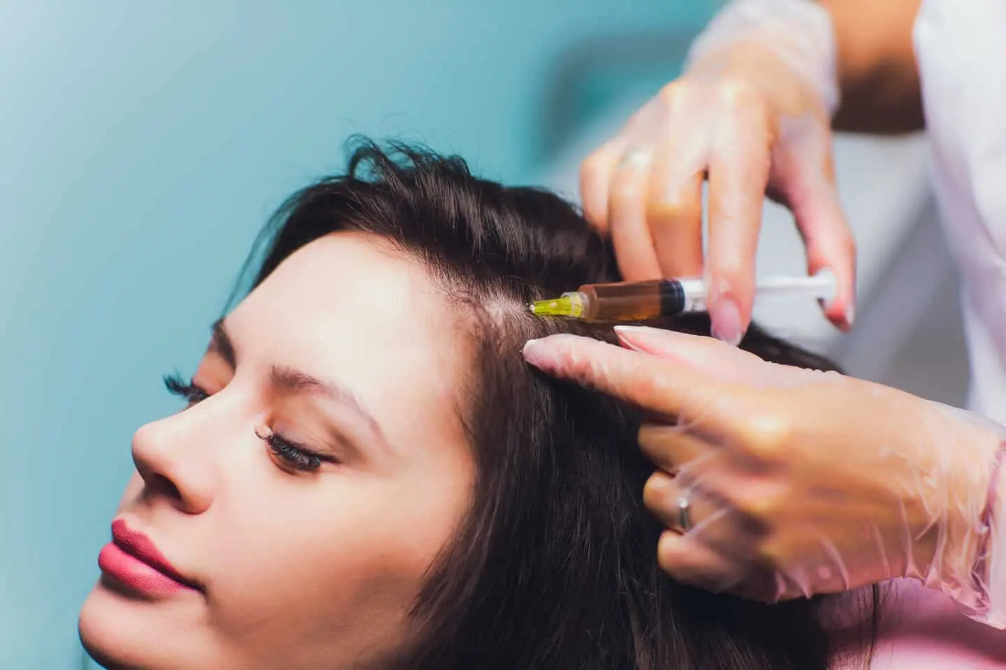 prp-treatment-for-hair