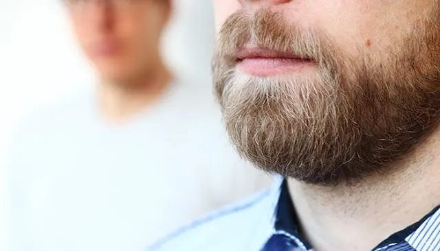 what-is-the-cost-of-a-beard-transplant